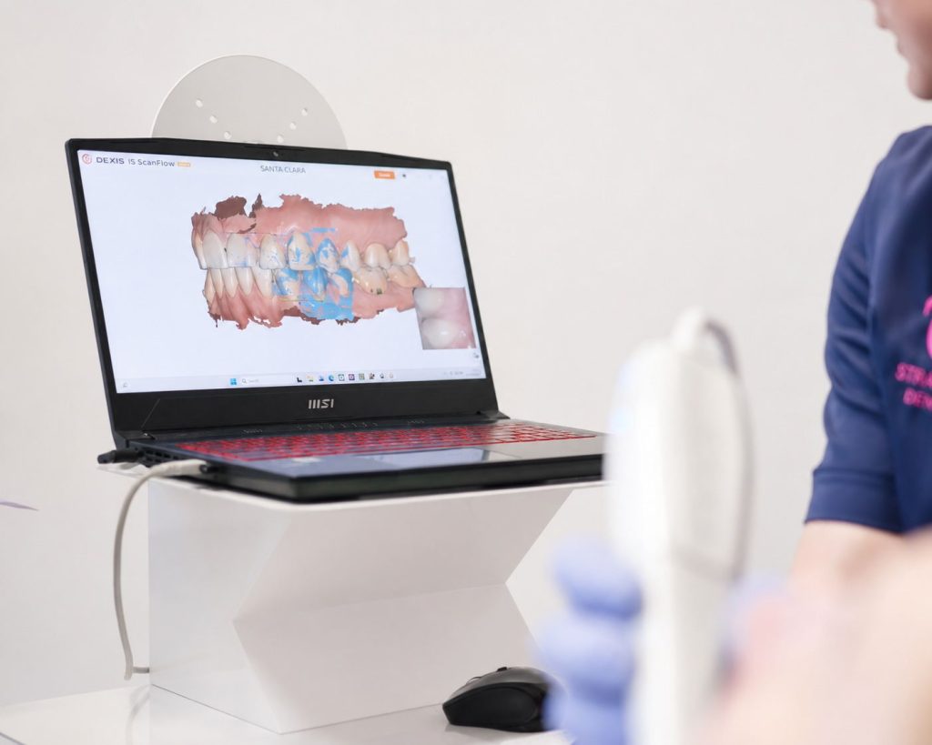 La scansione 3D dell'arcata dentale sul computer accanto alla poltrona