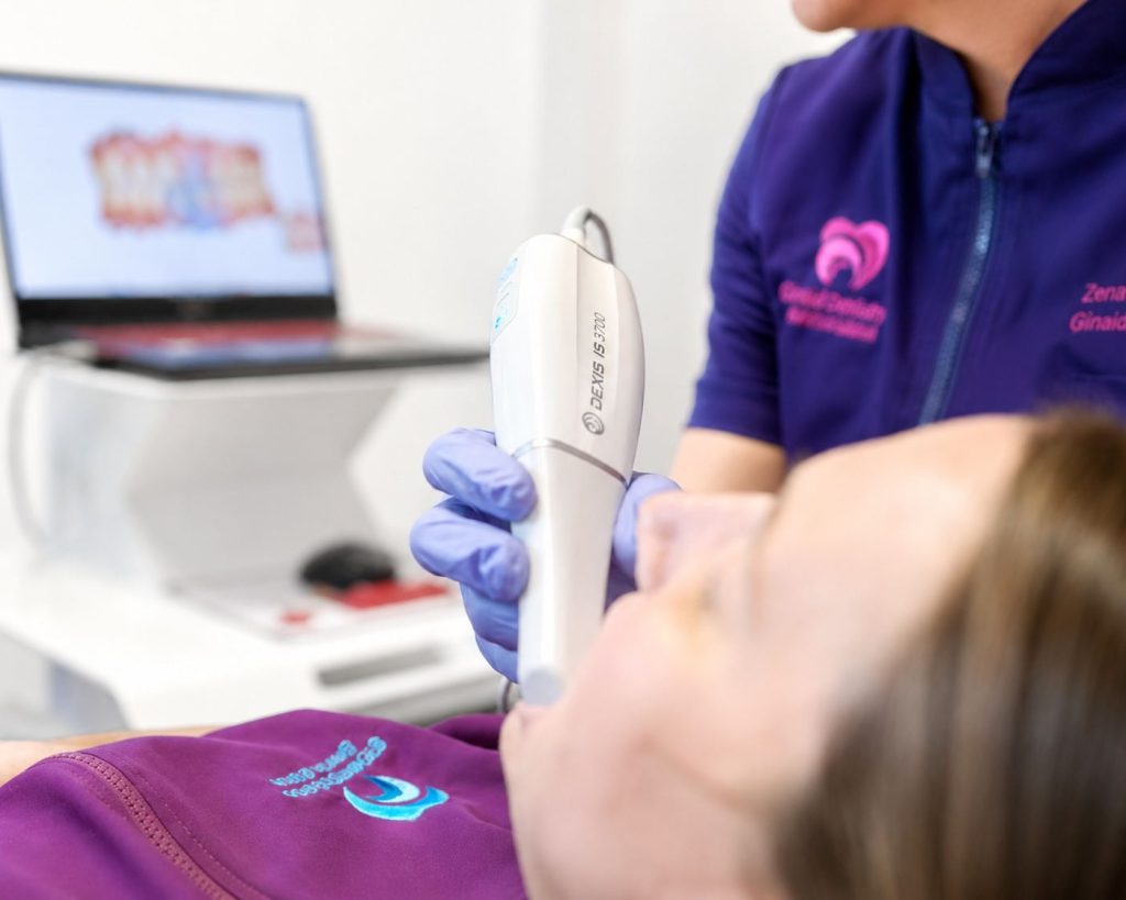 Impronta digitale con lo scanner intraorale su una paziente